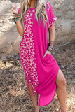 Casual Vintage Leopard Pocket Asymmetrical O Neck A Line Dresses(3 Colors)